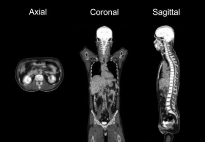 CT Scan Axial, Coronal & Sagittal Cross Sections